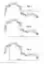 Fig. 04 - Clostridium difficile toxin-based vaccine