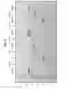 Fig. 63 - Clostridium difficile toxin-based vaccine