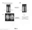 Fig. 04 - Bacterial vaccine components and uses thereof