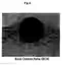 Fig. 04 - BIOMATERIAL COATED WITH HAp/Col COMPOSITE