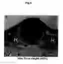 Fig. 05 - BIOMATERIAL COATED WITH HAp/Col COMPOSITE