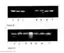 Fig. 06 - MTB-C vaccine against asthma