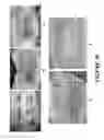 Fig. 32 - Composition and methods for reduced scarring and treatment of fibrosis