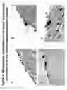 Fig. 03 - Composition and method for sulfated non-anticoagulant low molecular weight heparins in cancer and tumor metastasis