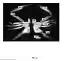 Fig. 02 - SEAFOOD PACKAGING AND PASTUERIZATION METHOD AND SYSTEM