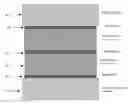 Fig. 01 - Methods for thick films thermoelectric device fabrication