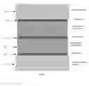 Fig. 06 - Methods for thick films thermoelectric device fabrication