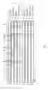 Fig. 08 - Polymerase idling method for single molecule DNA sequencing
