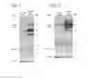 Fig. 02 - Biomarker for determining mitochondrial damage in friedreich's ataxia