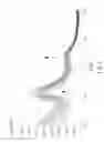 Fig. 06 - Protease assay
