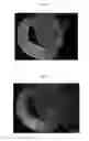 Fig. 02 - Method for producing ciliary marginal zone-like structure