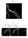 Fig. 06 - Method for producing ciliary marginal zone-like structure