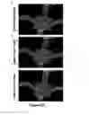 Fig. 33 - Printed assemblies of ultrathin, microscale inorganic light emitting diodes for deformable and semitransparent displays