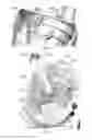 Fig. 06 - Wireless Communication Device