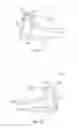 Fig. 05 - Golf club head with flexure