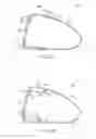 Fig. 14 - Golf club head with flexure