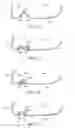 Fig. 17 - Golf club head with flexure