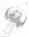 Fig. 02 - LANTERN-TYPE GEAR UNIT