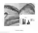 Fig. 03 - Compositions and methods for treating clostridium infection and preventing recurrence of infection