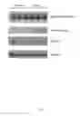 Fig. 02 - METHOD FOR DIAGNOSIS AND TREATMENT OF PROLACTIN ASSOCIATED DISORDERS