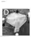 Fig. 07 - Pharmaceutical compositions comprising glitazones and Nrf2 activators
