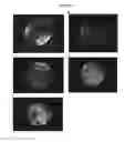 Fig. 08 - CRYSTALLIZATION METHODS FOR PURIFICATION OF MONOCLONAL ANTIBODIES
