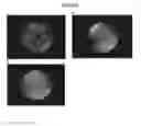 Fig. 09 - CRYSTALLIZATION METHODS FOR PURIFICATION OF MONOCLONAL ANTIBODIES