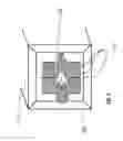 Fig. 04 - Method For Compensating The Deviation Of A Hadron Beam Produced By A Hadron-Therapy Installation