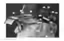 Fig. 01 - Hearing devices based on the plasticity of the brain