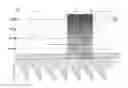 Fig. 02 - Hearing devices based on the plasticity of the brain