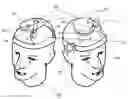 Fig. 01 - HINGED TRANSCRANIAL MAGNETIC STIMULATION ARRAY FOR NOVEL COIL ALIGNMENT