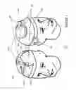 Fig. 02 - HINGED TRANSCRANIAL MAGNETIC STIMULATION ARRAY FOR NOVEL COIL ALIGNMENT