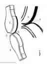 Fig. 09 - HINGED TRANSCRANIAL MAGNETIC STIMULATION ARRAY FOR NOVEL COIL ALIGNMENT