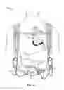 Fig. 04 - Modular implantable medical pump