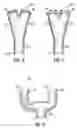 Fig. 06 - Bifurcated outflow cannulae