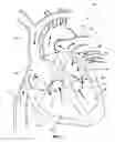 Fig. 02 - Ventricular assist device and related methods