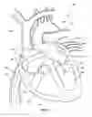 Fig. 03 - Ventricular assist device and related methods