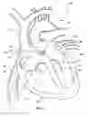 Fig. 04 - Ventricular assist device and related methods