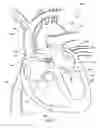 Fig. 08 - Ventricular assist device and related methods