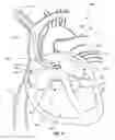 Fig. 09 - Ventricular assist device and related methods