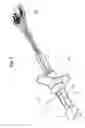 Fig. 02 - Perineal probe