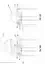 Fig. 10 - Disposable and reusable complex shaped see-through endoscope