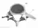 Fig. 01 - Endoscopic fusion system and method with neuromonitoring