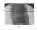 Fig. 03 - Endoscopic fusion system and method with neuromonitoring