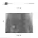 Fig. 04 - Endoscopic fusion system and method with neuromonitoring