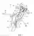 Fig. 02 - Surgical access system and related methods
