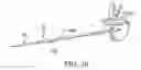 Fig. 11 - Surgical access system and related methods
