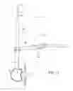 Fig. 14 - Surgical access system and related methods