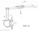 Fig. 15 - Surgical access system and related methods
