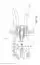 Fig. 17 - Surgical access system and related methods